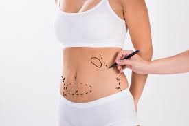 Liposukcja ultradźwiękowa